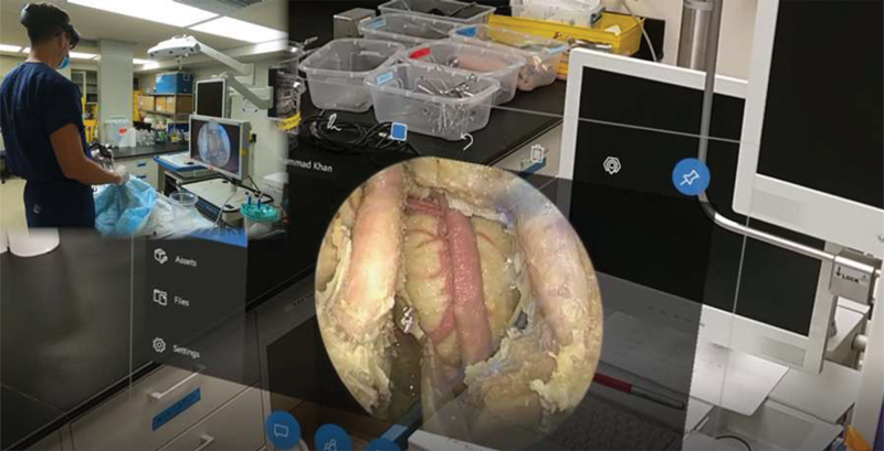 Streaming 2D-Endoscopic Video into an Augmented Reality Headset Display: A Feasibility Study