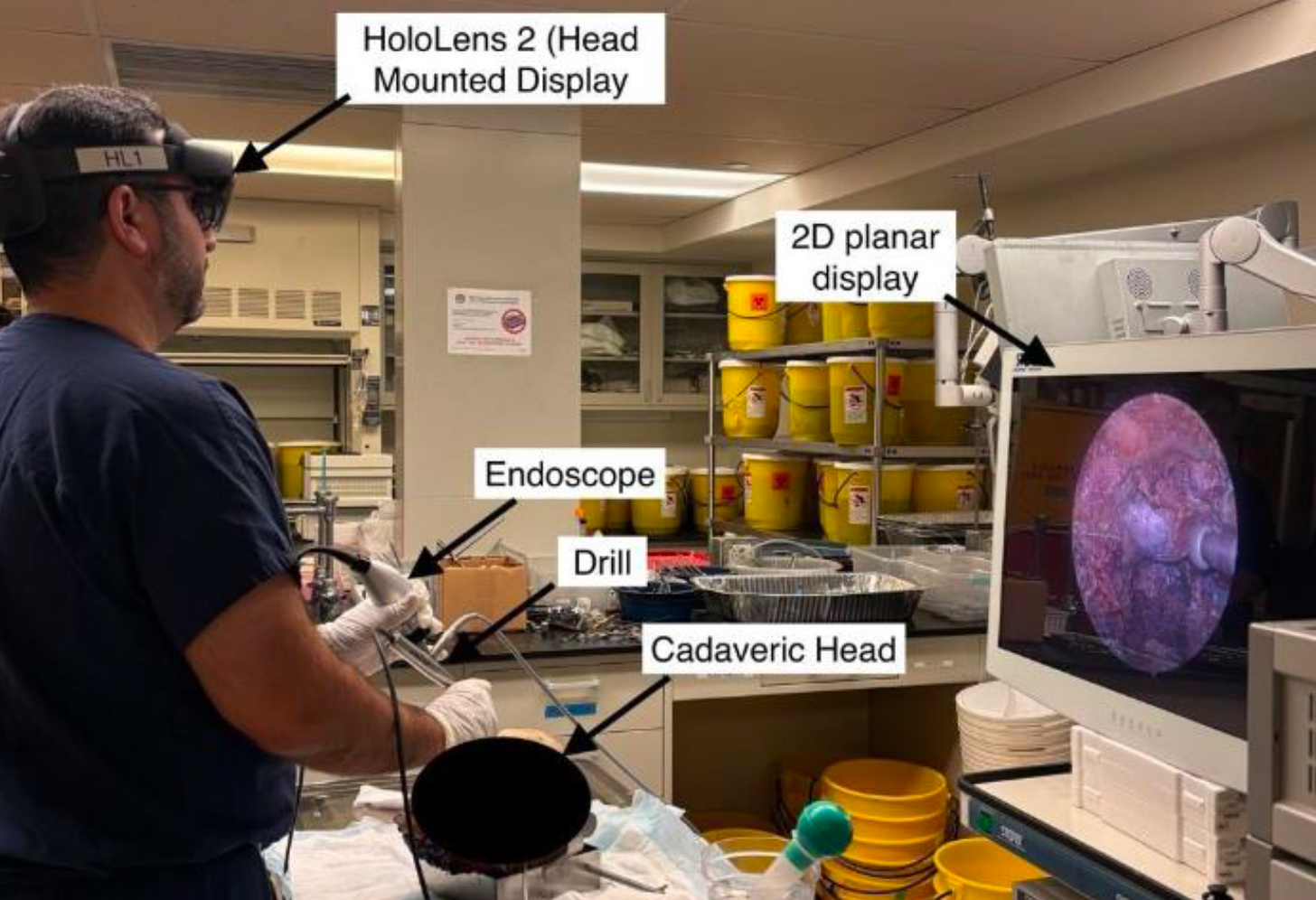 Application of Mixed Reality in Endoscopic Streaming during Skull Base Surgery